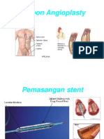 Balloon Angioplasty