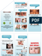 Leaflet Konjungtivitis