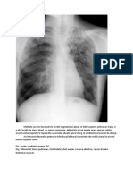 Radiografii