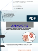 Apendicitis