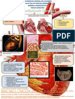 amiloidosis-cardiaca