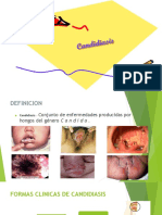 Candidiasis