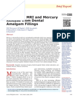 High-Field MRI and Mercury Release From Dental Amalgam Fillings