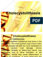 cholecystolithisais