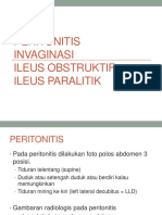 Peritonitis, Invaginasi, Ileus Obstruktif, Ileus Paralitik