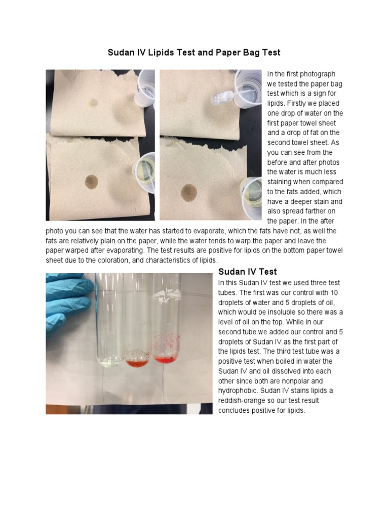 ⛔ Sudan iii test for lipids. Why do we use Sudan III to identify lipids