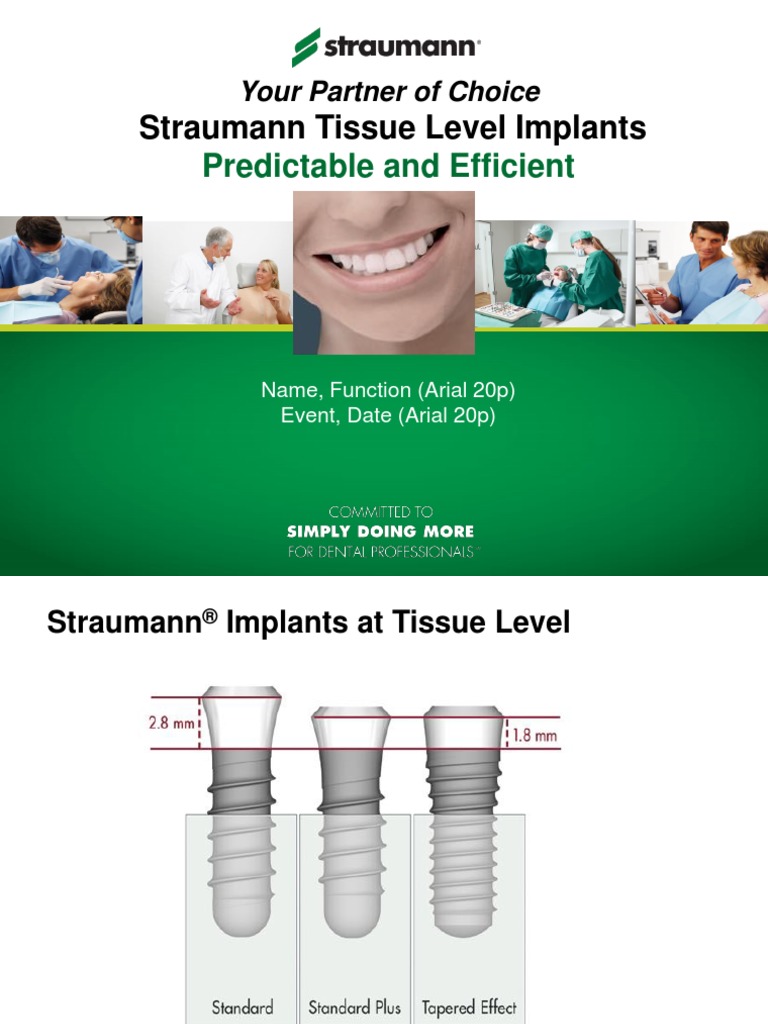 2 Straumann Implants TL | Dental Implant | Face | Free 30-day Trial ...