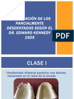 Clasificación de Los Parcialmente Desdentados Según El Dr