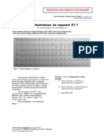 Supradenivelarea de Segment ST MedicinadeUrgentainImagini 2016 RMU