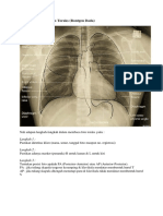 Belajar Membaca Foto Toraks