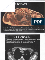 SECTIUNI CT TORACE.ppt