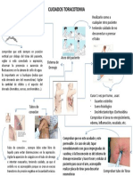 Cuidados tras toracotomía menos de