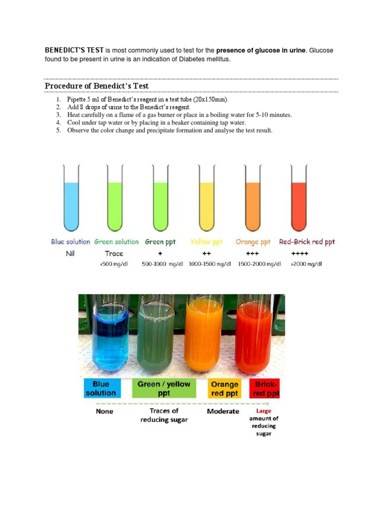 Benedict's and Heat and Acetic Acid Test
