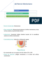 Bloqueo Del Nervio Mentoniano