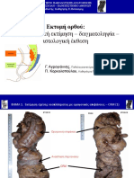 Total Mesorectal Excision