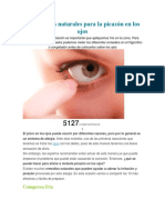 10 remedios naturales para la picazón en los ojos.docx