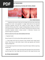 Download Penatalaksanaan Kuratif Tinea Pedis by Rickky KurniawanMD SN36250129 doc pdf