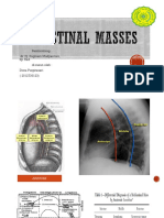 Mediastinal Masses