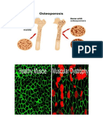 Impaired Musculoskeletal