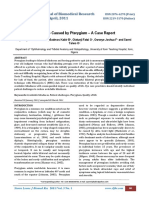 Blindness Caused by Pterygium - A Case Report