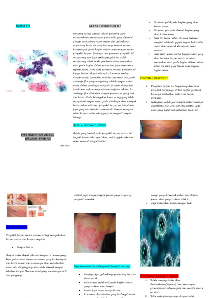 Herpes
