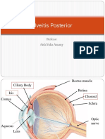 Uveitis Posterior.pptx