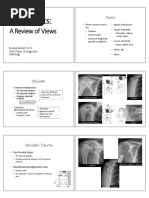 Xrays Mini Tutorial