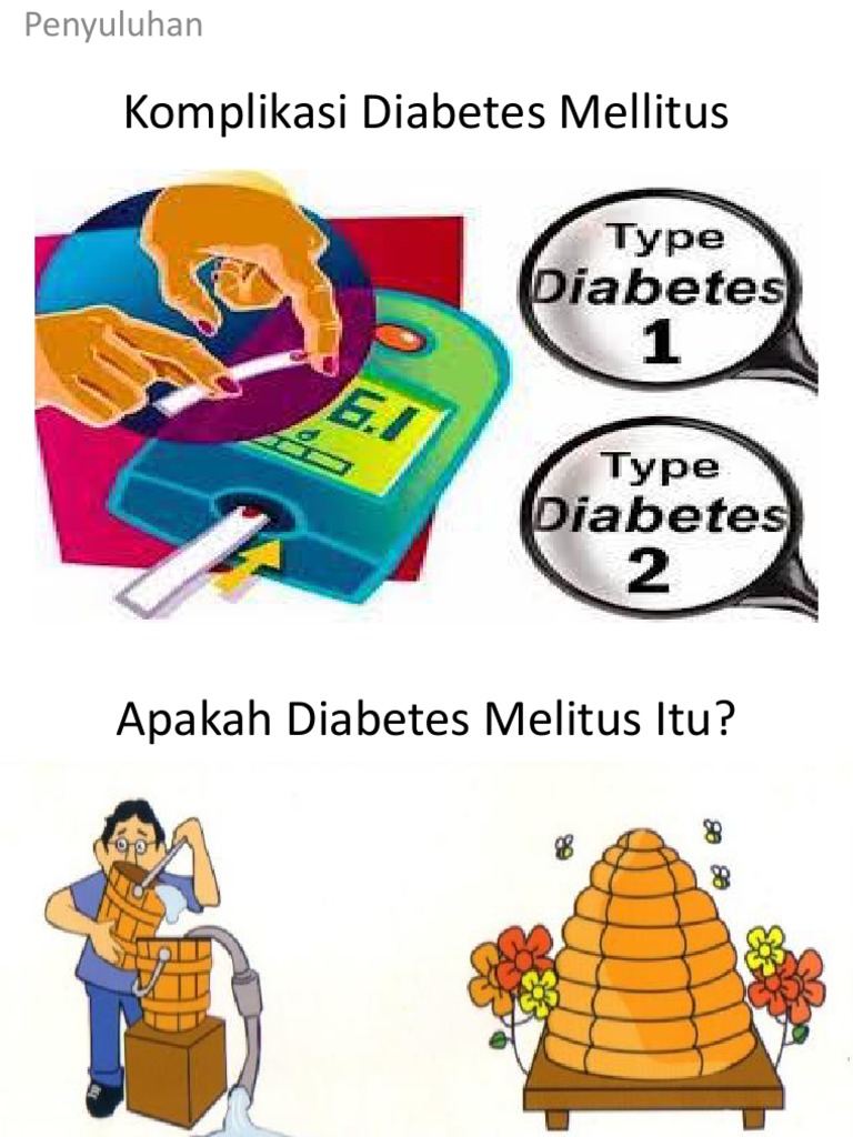 Komplikasi  Diabetes  Mellitus  Komplikasi  Diabetes  Mellitus