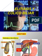 Colelitiasis y Colico Biliar