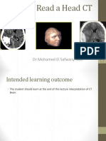 How To Read A Head CT: DR Mohamed El Safwany. MD