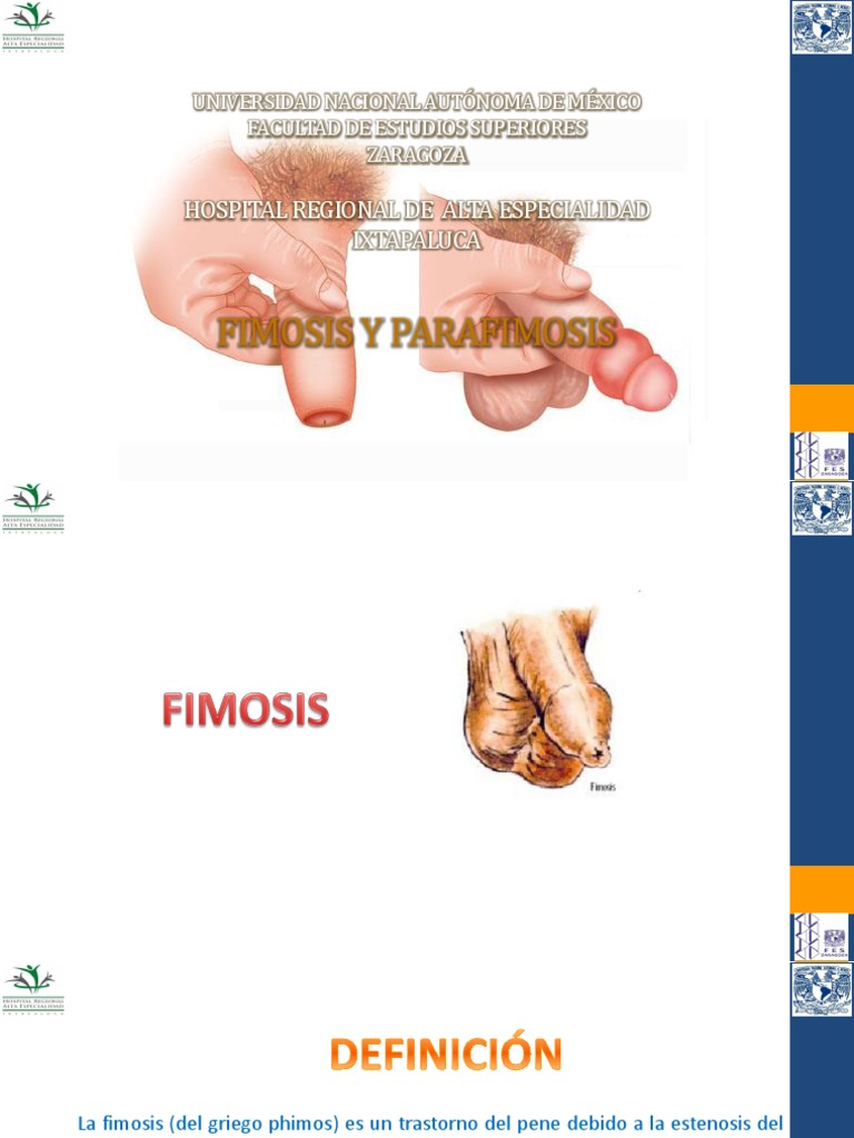 Fimosis y Parafimosis: Diagnóstico y Tratamiento | PDF | Anatomia
