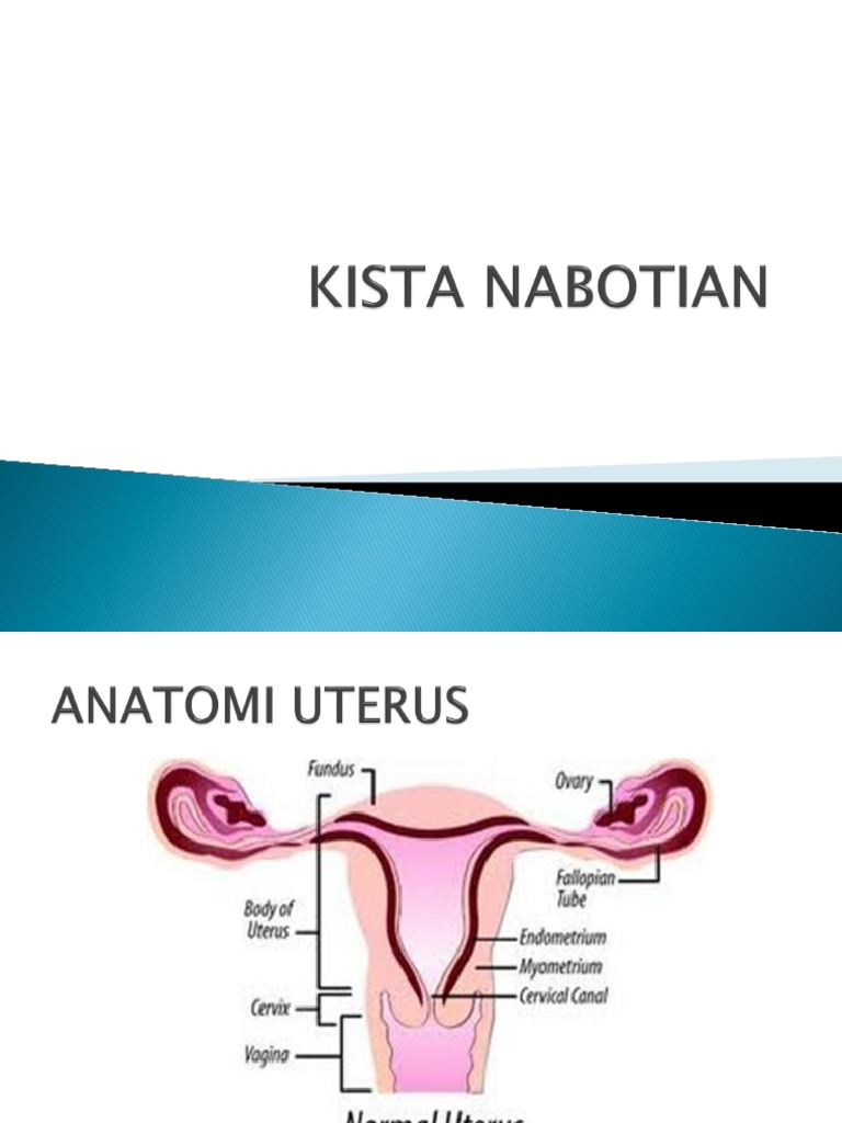 Kista Nabothi: Gejala dan Penanganan | PDF | Kesehatan Holistik | Sains ...