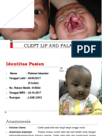 CLEFT LIP PALATE