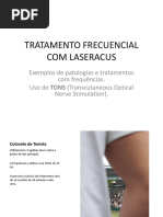Tratamento Frecuencial Com Laseracus