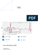 EKG.pptx