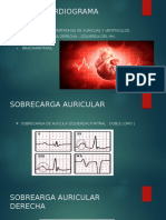 Ecg Patologico