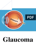Glaucoma Chapter