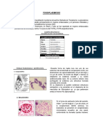 Toxoplasmosis