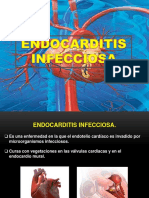 Endocarditis Infecciosa.