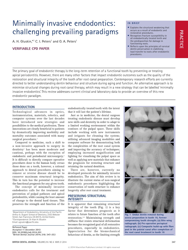 Minimally Invasive Endodontics Challenging Prevailing Paradigms Tooth