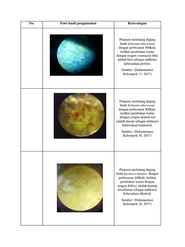 Uxlayotgan yalangoch kokrak fotosurati