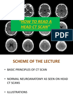 How to Read a Head CT Scan in 40 Steps