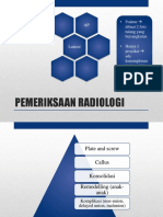 Fracture Tulang