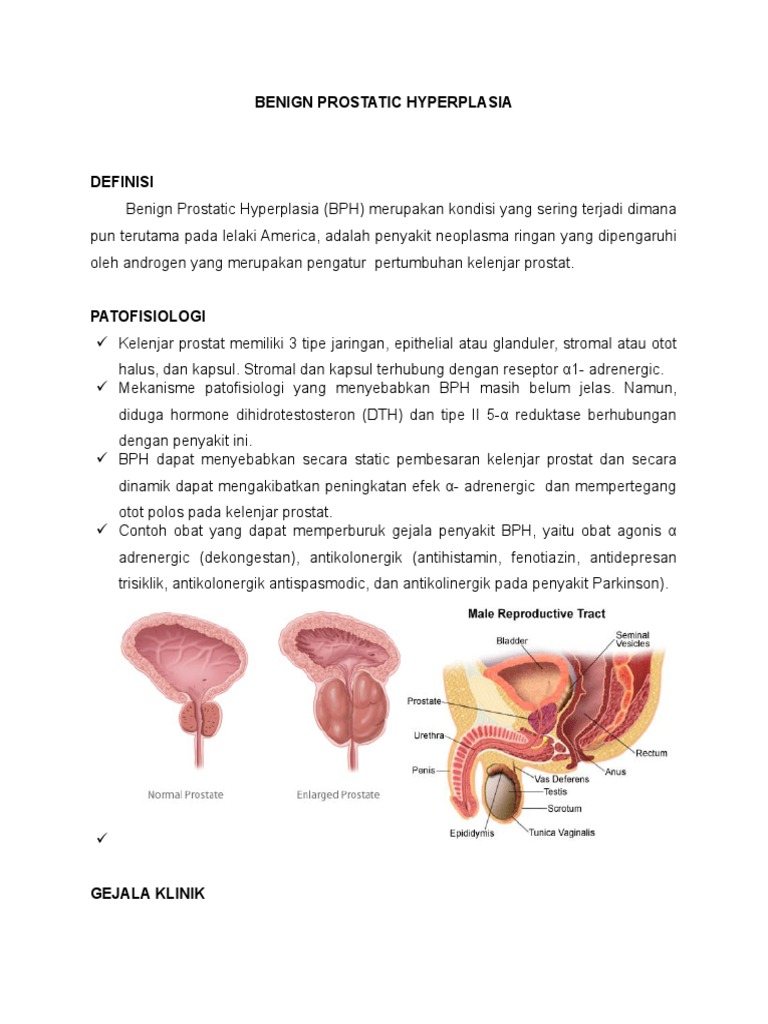 Benign Prostatic Hyperplasia | PDF