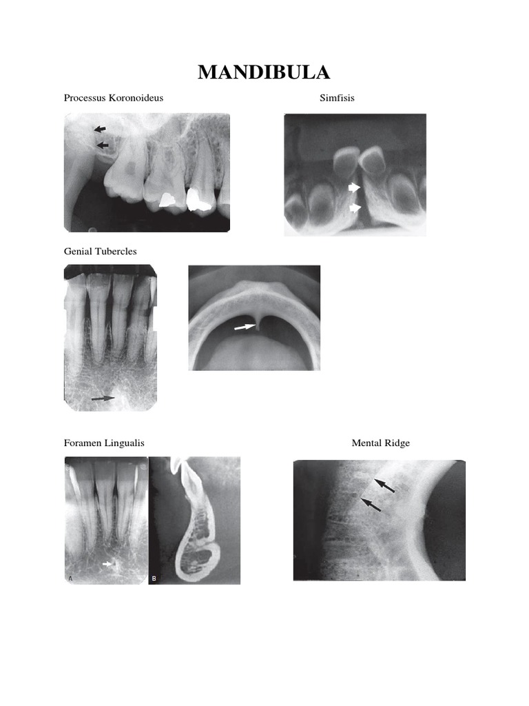 Radiograf Mandibula | PDF