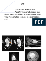 MRI Abc