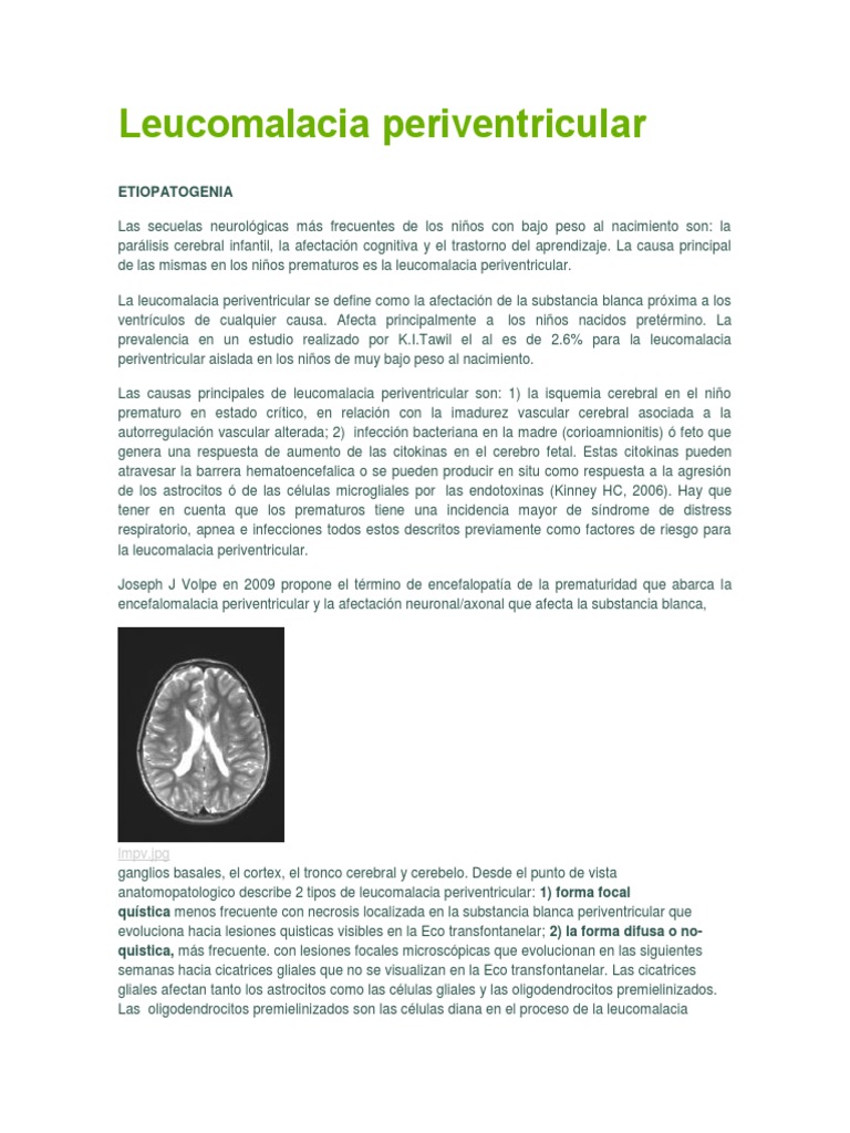 Leucomalacia Periventricular Paralisis Cerebral Sistema Nervioso