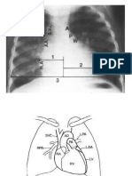 X Ray - Pediatric