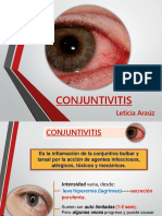 Conjuntivitis Charla ORIGNAL