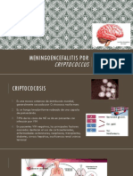 Meningoencefalitis Por Cryptococcus II